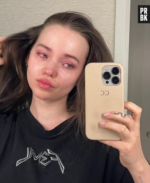 Dove Cameron faz foto chorando e desabafa sobre saúde mental