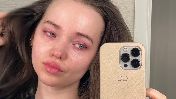 Dove Cameron revela luta contra depressão e disforia: "Desaprender o ódio próprio"