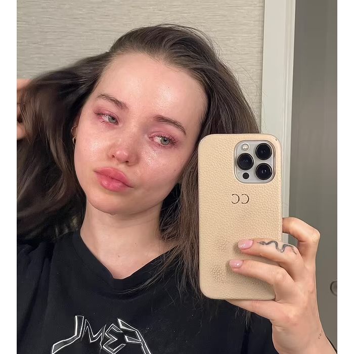 Dove Cameron faz foto chorando e desabafa sobre saúde mental