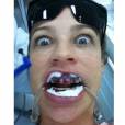 Você acha que artista não sofre para ficar linda?! Luana Piovani fez um tratamento bucal e postou uma foto do processo. Com cara de maluca e cheio de ferramentos nos dentes, a atriz provou que não é mole não ser bonita!