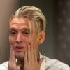 Aaron Carter aparentava estar envelhecido por causa das drogas