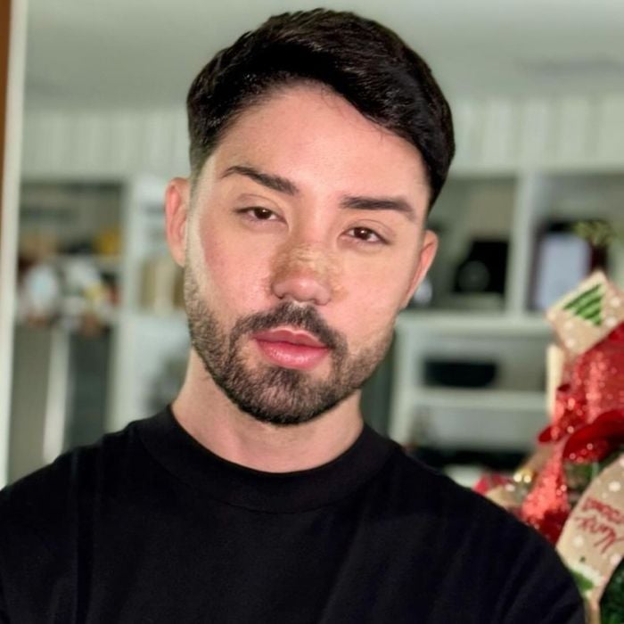 Antes e depois de Rico Melquiades: influenciador revela novo rosto