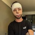 Rico Melquiades realizou 5 cirurgias plásticas no rosto