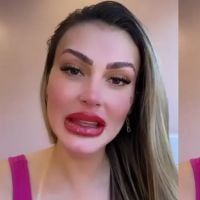 Boca de Andressa Urach impressiona por tamanho após procedimento. Modelo fez tratamento "efeito batom"