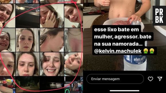 Ladrão rouba o celular, descobre que namorado da vítima é abusivo e expõe agressões com fotos e prints