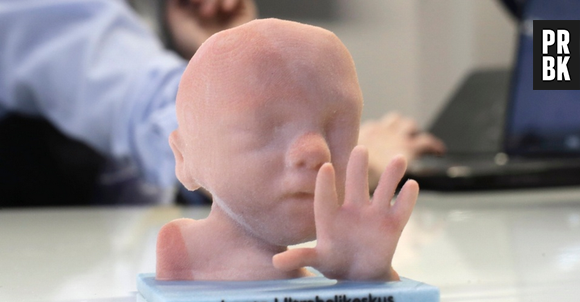 Esses fetos criados por impressoras 3D chegam a dar muito medo