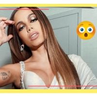 "Doença do Beijo": Anitta tem diagnóstico de vírus Epstein-Barr. Entenda!