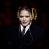 Madonna levanta debate sobre body shaming após críticas por rosto inchado no Grammy