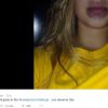 Algumas meninas se deram mal ao tentarem copiar os lábios de Kylie Jenner