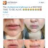Ai, essa doeu! Nem Kylie Jenner e seus lábios aprovariam a participação dessa fã no #KylieJennerChallenge