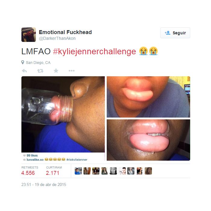  Adolescentes conseguem ter os l&amp;aacute;bios de Kylie Jenner temporariamente sugando o ar de uma garrafa de vidro com a boca 