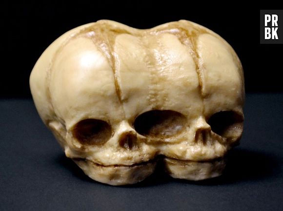 Vai querer um pedaço desse bolo de crânio?