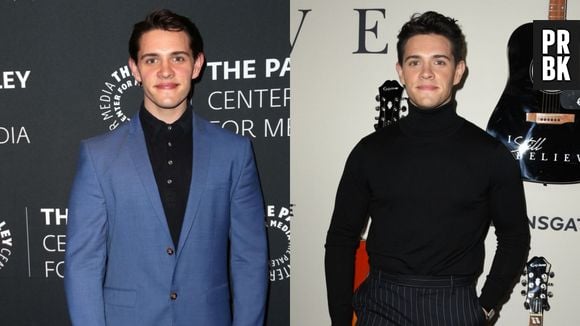 Antes e depois de Casey Cott