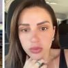 Influencer fala sobre caso da clínica de estética que compartilhou fotos de clientes nuas