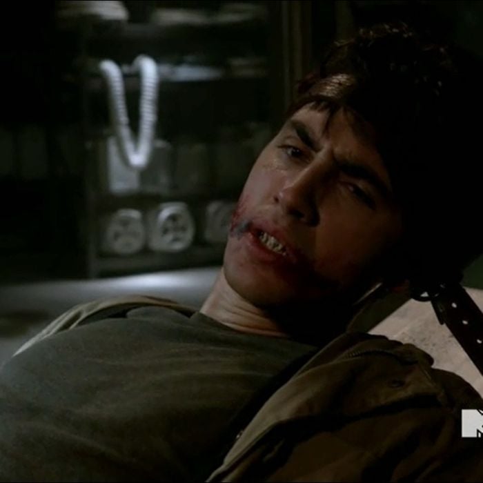 Donovan (Ashton Moio) foi transformado em um ser sobrenatural em &quot;Teen Wolf&quot;