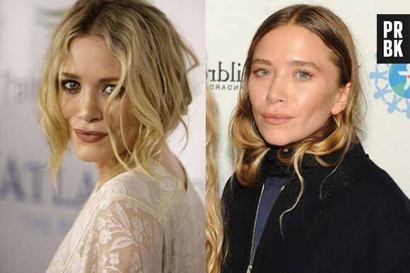 Mary Kate Olsen antes e depois da plástica