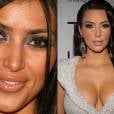 Kim Kardashian só tem a agradecer aos cirurgiões plásticos