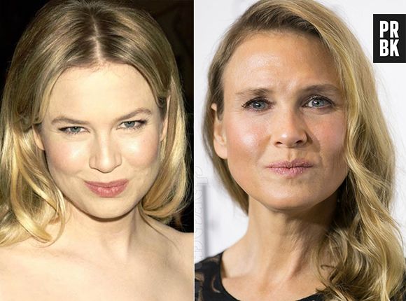 Renee Zellweger chocou todo mundo recentemente com a sua aparência