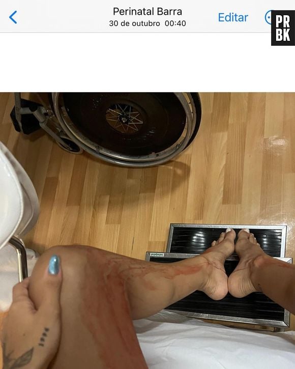 Gabi Brandt teve deslocamento de placenta e hematomas na gravidez