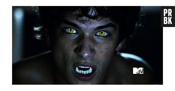 Em "Teen Wolf": veja 8 provas de que a primeira temporada da série foi completamente trash!