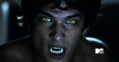 Em "Teen Wolf": veja 8 provas de que a primeira temporada da série foi completamente trash!