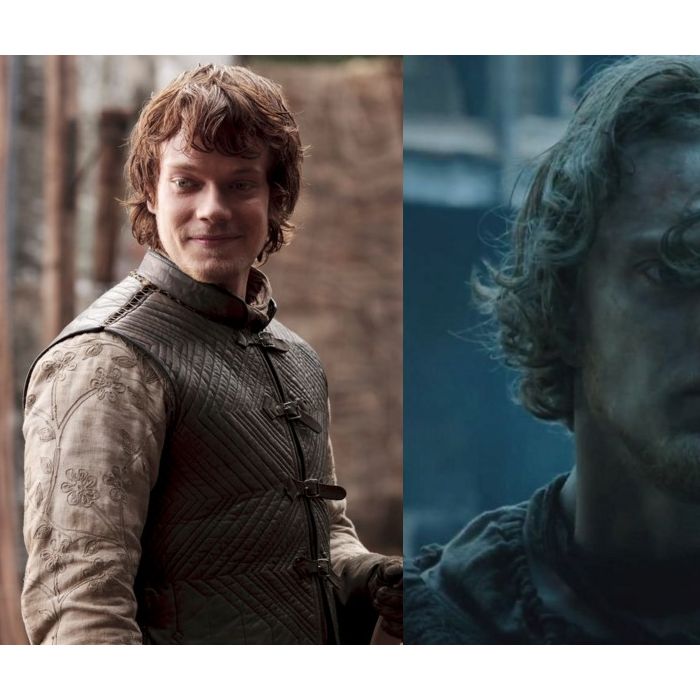 Theon Greyjoy (Alfie Allen), de &quot;Game of Thrones&quot;, também está bastante desgastado, né?