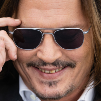 Dente amarelo como o de Johnny Depp pode não ser falta de higiene. Entenda!