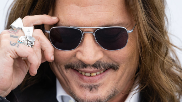 Dente amarelo como o de Johnny Depp pode não ser falta de higiene. Entenda!