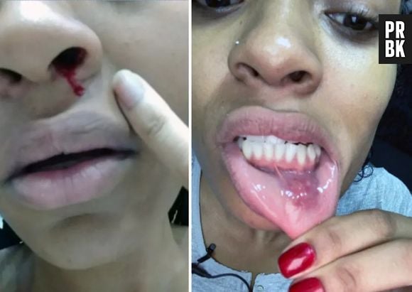 Fotos chocantes de agressão sofrida por Patrícia Ramos