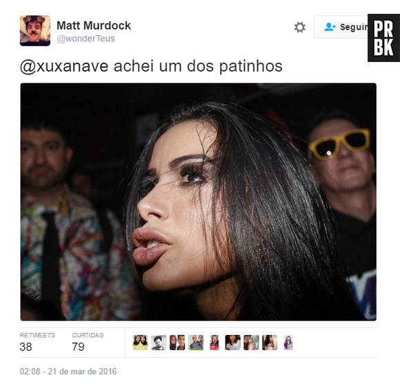 Anitta virou meme nas redes sociais por conta do preenchimento que fez na boca