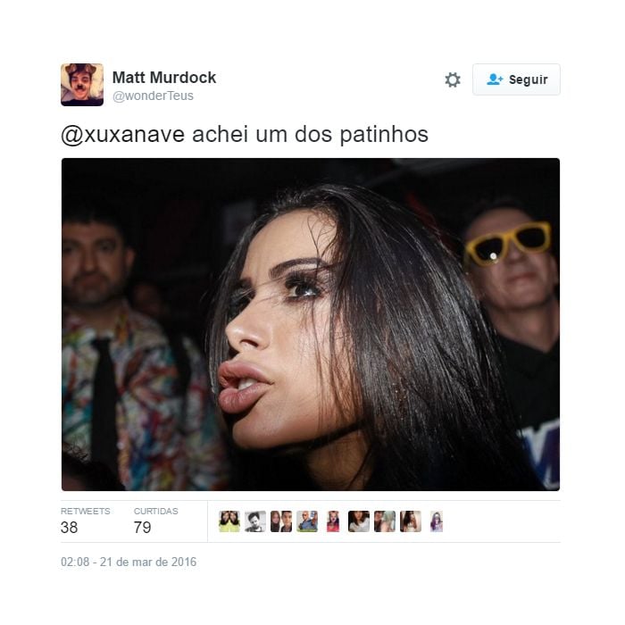 Anitta virou meme nas redes sociais por conta do preenchimento que fez na boca