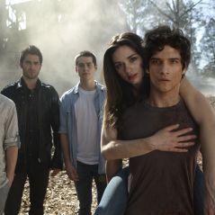 Esta é a lista de tudo de mais doido que aconteceu em "Teen Wolf"