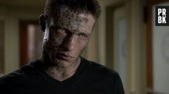 Quem não ficou com pena do Jackson (Colton Haynes) em "Teen Wolf" e sua transformação que deu errado?