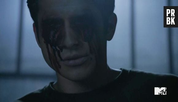 No último episódio de "Teen Wolf", Scott (Tyler Posey) arranca seus próprios olhos para derrotar Anuk-Ite