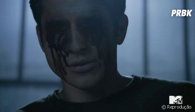 No último episódio de "Teen Wolf", Scott (Tyler Posey) arranca seus próprios olhos para derrotar Anuk-Ite