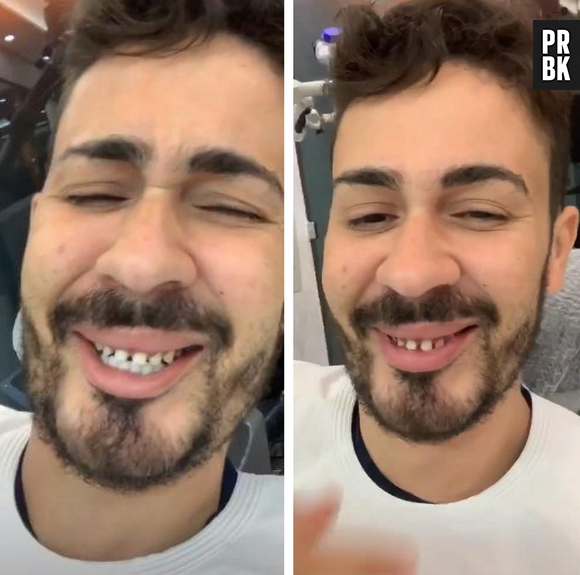 Carlinhos Maia revela como é seus dentes naturais sem a faceta