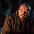  Beric Dondarrion (Richard Dormer) tem muitas hist&oacute;rias e marcas em "Game of Thrones" 