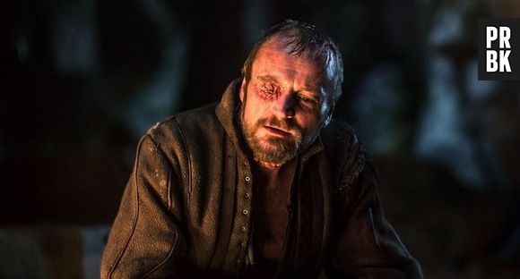 Beric Dondarrion (Richard Dormer) tem muitas histórias e marcas em "Game of Thrones"