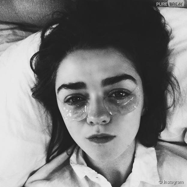 Maisie Williams, a Arya de "Game of Thrones", está com os olhos inflamados por causa das lentes de cegueira da personagem