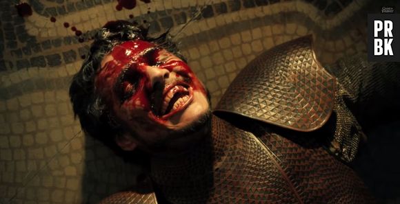 Com o rosto todo "machucado" Oberyn Martell (Pedro Pascal) ri da sua situação