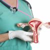 Menstruação: como ela funciona? O que é?